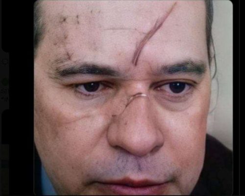 Queda de Toffoli favorece interesses inconfessáveis de Lula