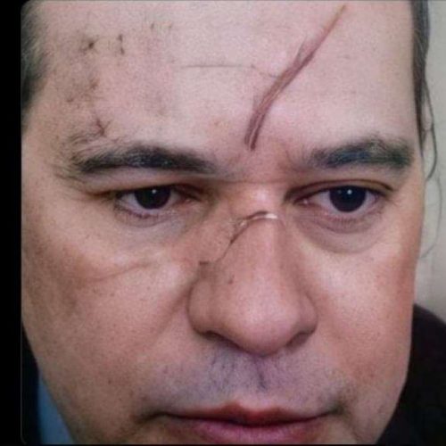 Queda de Toffoli favorece interesses inconfessáveis de Lula