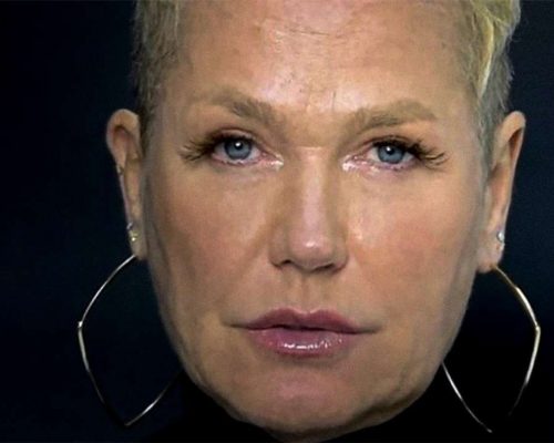 Xuxa Meneghel em observação: o que a equipe revelou