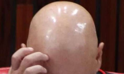 Patrimônio imobiliário de servidor público revela imensa fortuna — e pode ser apenas a ponta do iceberg