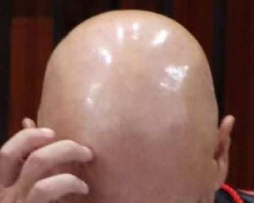 Patrimônio imobiliário de servidor público revela imensa fortuna — e pode ser apenas a ponta do iceberg