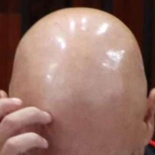 Patrimônio imobiliário de servidor público revela imensa fortuna — e pode ser apenas a ponta do iceberg