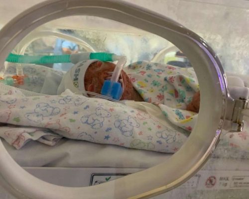 Com síndrome rara, o pequeno João Guilherme luta pela vida e precisa de ajuda