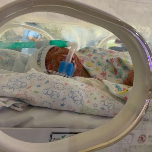 Com síndrome rara, o pequeno João Guilherme luta pela vida e precisa de ajuda
