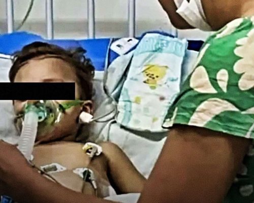Bets provocam amputação de mãos e pés em criança de 1 ano