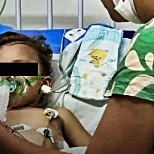 Bets provocam amputação de mãos e pés em criança de 1 ano