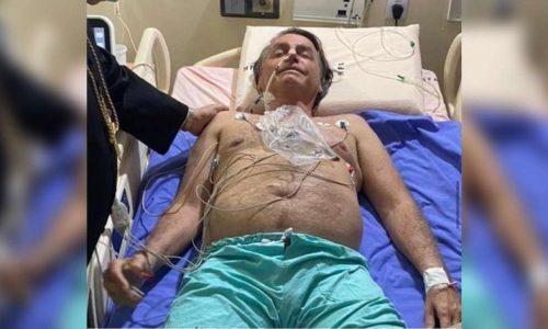 Associação de jornalistas denuncia tratamento desumano contra Bolsonaro e alerta: “Um crime em curso”