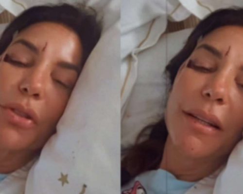 Ivete Sangalo é internada em hospital após desmaio e aparece com hematomas no rosto
