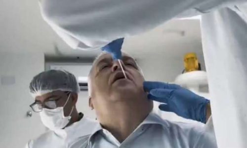 Relator da CPMI do INSS realiza exame de DNA após acusações covardes de Lindbergh e Soraya