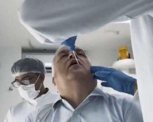 Relator da CPMI do INSS realiza exame de DNA após acusações covardes de Lindbergh e Soraya