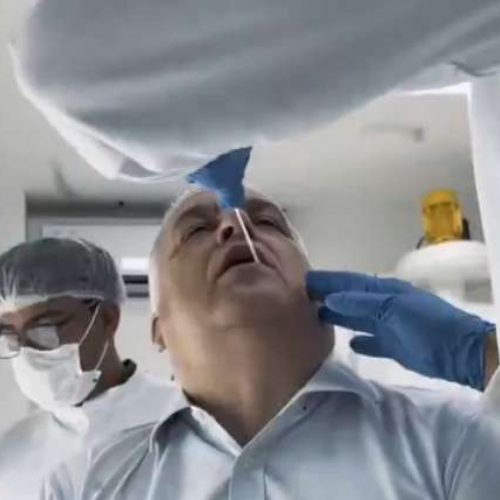 Relator da CPMI do INSS realiza exame de DNA após acusações covardes de Lindbergh e Soraya