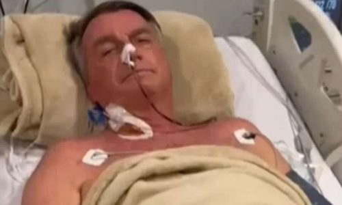 Bolsonaro deve passar por nova cirurgia em meio à prisão domiciliar