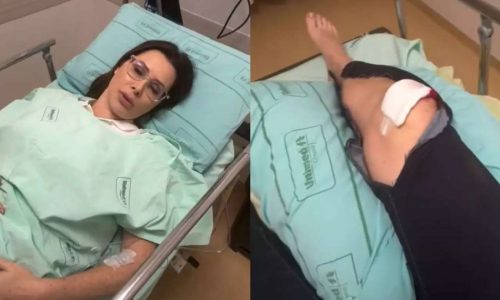 Deputada Carol De Toni sofre acidente doméstico, fratura patela em quatro pontos e passa por cirurgia