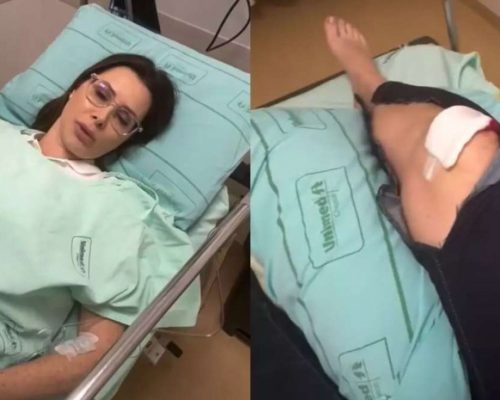 Deputada Carol De Toni sofre acidente doméstico, fratura patela em quatro pontos e passa por cirurgia